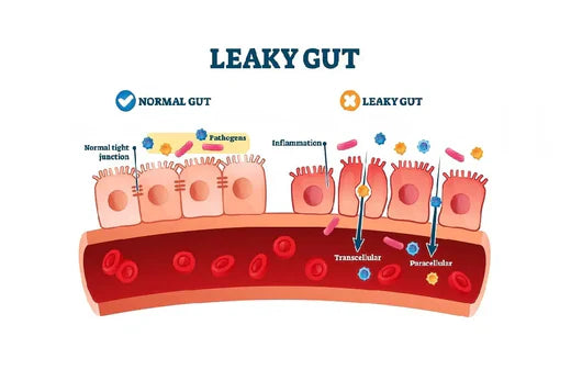 What is Leaky Gut Syndrome in Dogs?